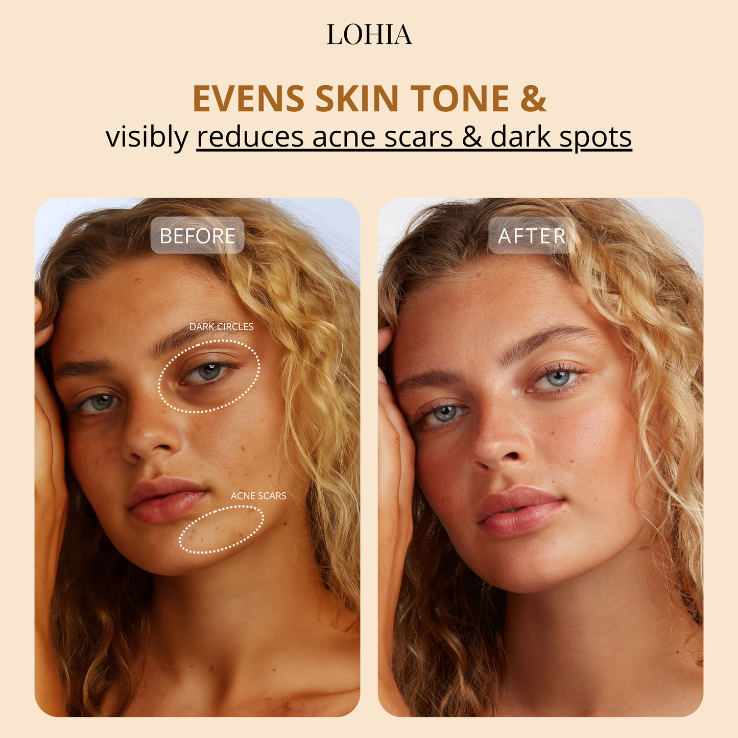 Lohia Serum Boosted Skin Tint Balm